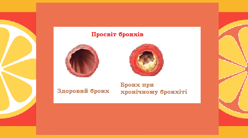 укр_изменения_в_больном_бронхе.png